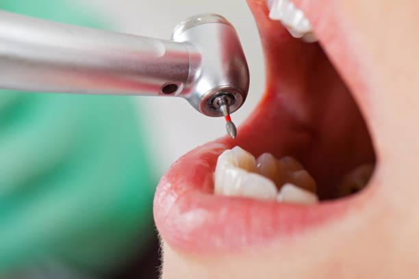 Best Weekend Emergency Dentist in Fenton, MO